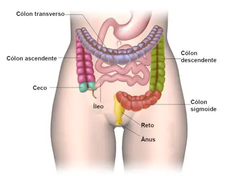 O Tumor Precoce e a Acometimento do Intestino Grosso